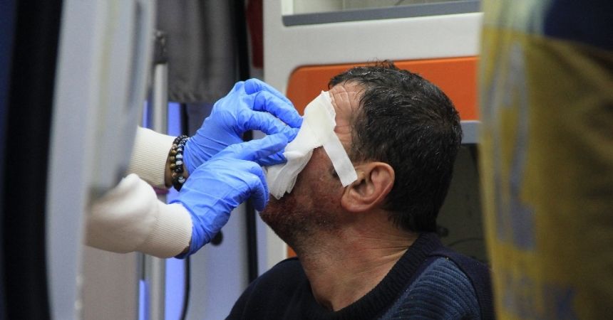 Arkadaşını yüzünden bıçakladı