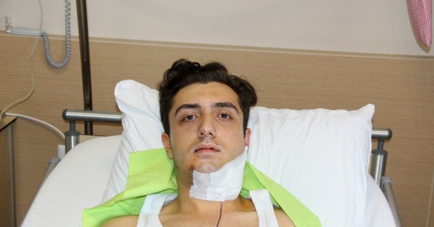 Tek yumrukla çenesini iki yerden kırdı