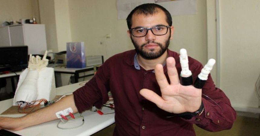 Kendine protez parmak yaptı