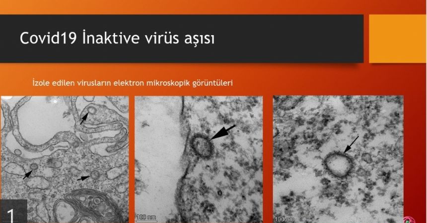 Ercüment Ovalı'nın aşısı deneye hazır Ercüment Ovalı'nın aşısı deneye hazır