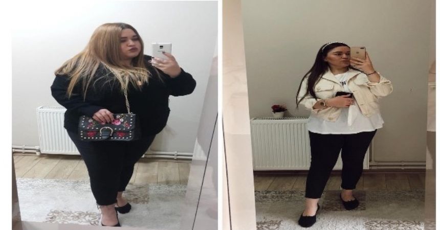 Mide ameliyatıyla 9 ayda 58 kilo verdi