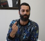 Survivor’dan sonra burnunu yaptırdı