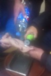 Sıkışan yüzüğü itfaiye çıkarttı