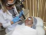 Güneş Lekelerinden “maske Peeling” İle Kurtulun
