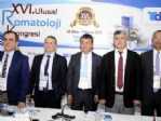 Bel Ağrısı, Sanatçı Suna Pekuysal Hastalığı Denilince Önemseniyor